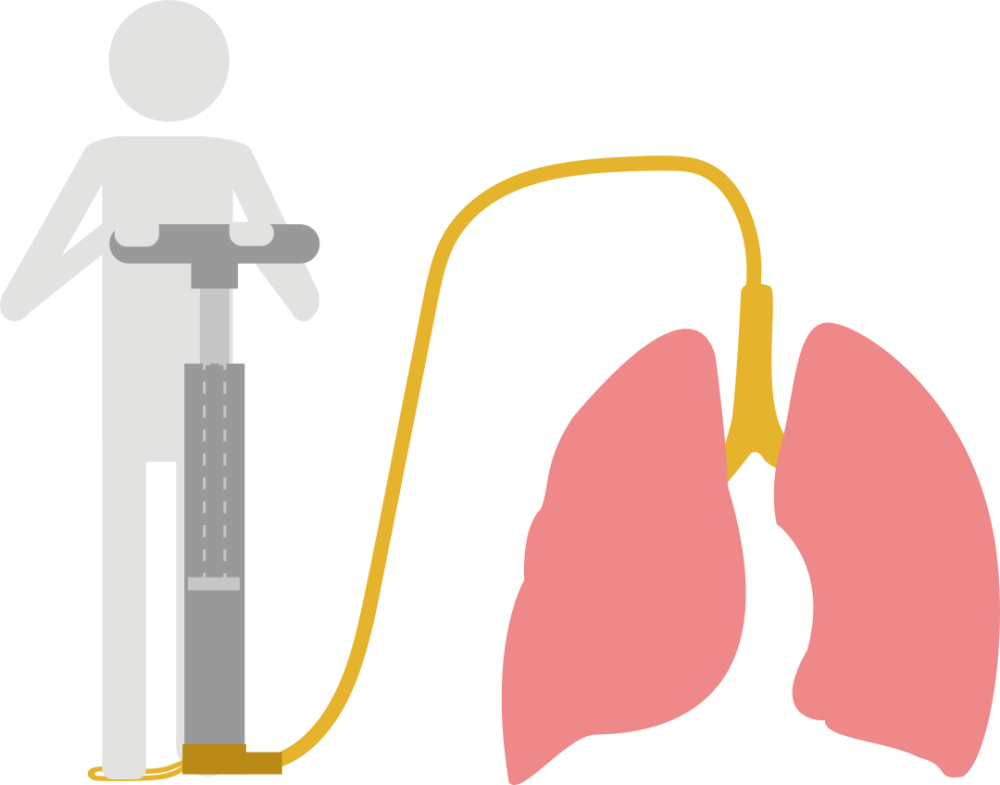 用呼吸机,医学上也称之为机械通气(ventilation)