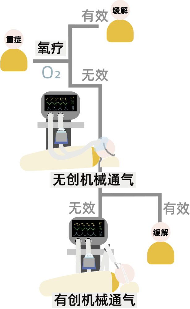 呼吸机工作原理 腾讯网