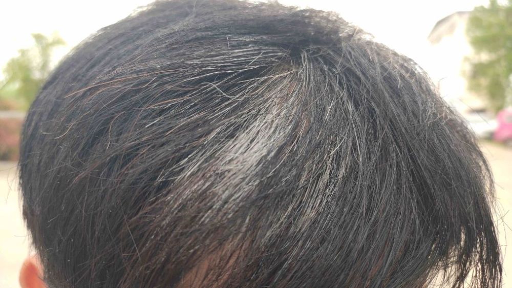 小伙种五十亩大蒜一夜变黄愁白头