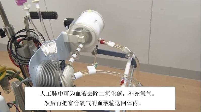 日本推出小型人工肺中国啥时能国产
