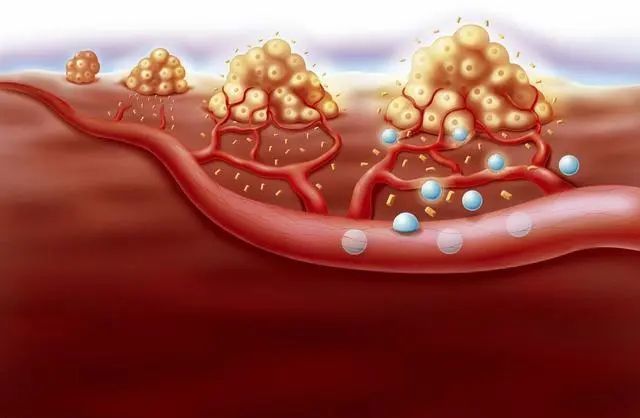身体有4个表现,说明血液已"黏稠如粥",谨记6个字,血管更畅通