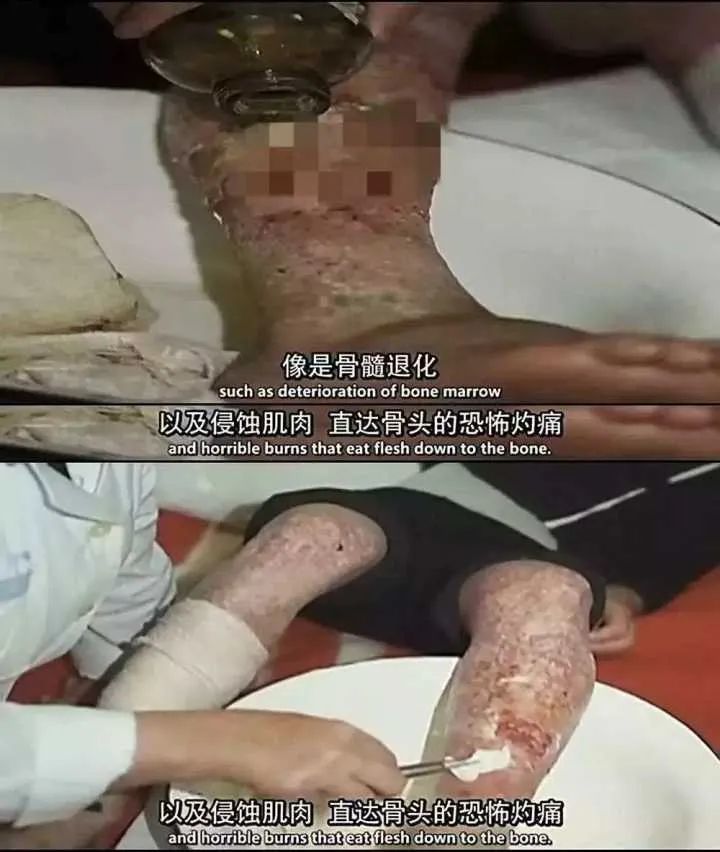 山火烧到切尔诺贝利乌克兰消防员为何不敢去救火