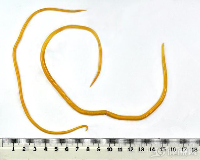 你吃过打虫药宝塔糖吗为什么突然消失了内行人给出答案