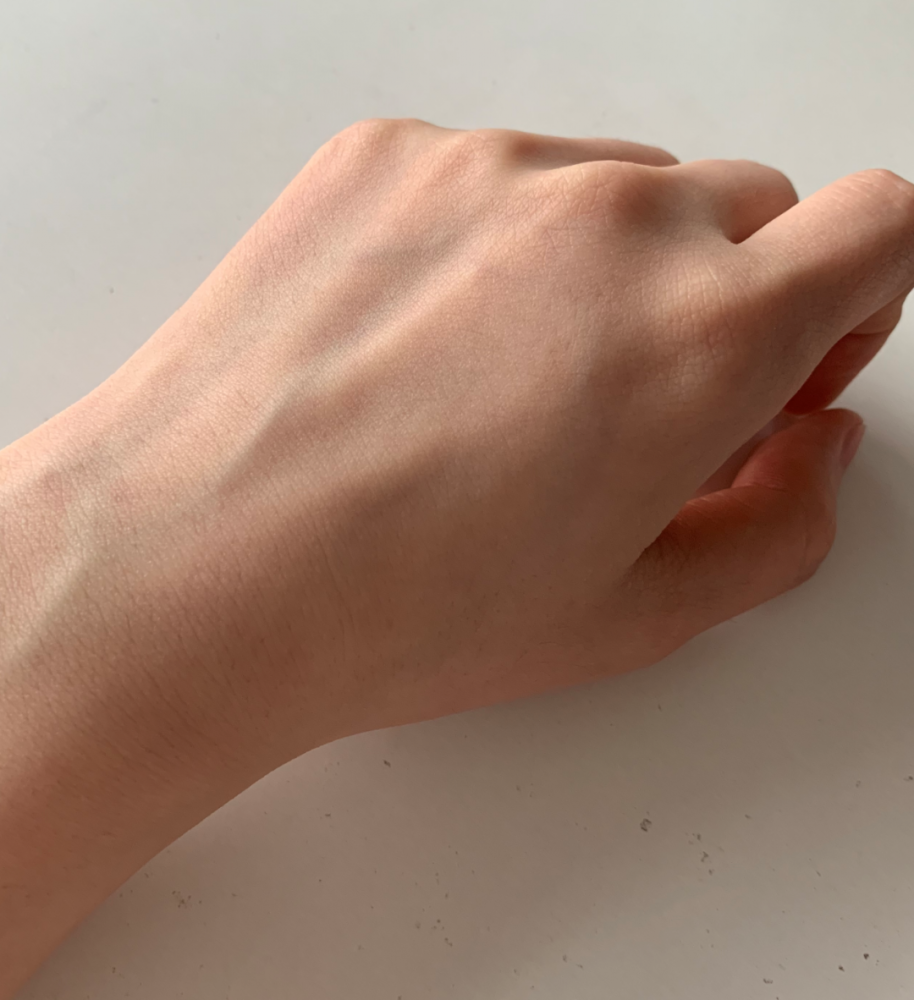 手背上弯弯曲曲的青蓝色"小蚯蚓",你了解多少?_腾讯新闻