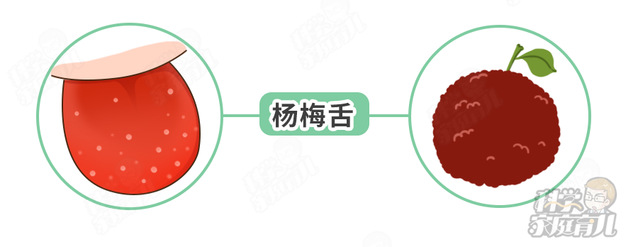 持续2~3天后,草莓舌变成杨梅舌,白色舌苔脱落,但仍然有白色点点.