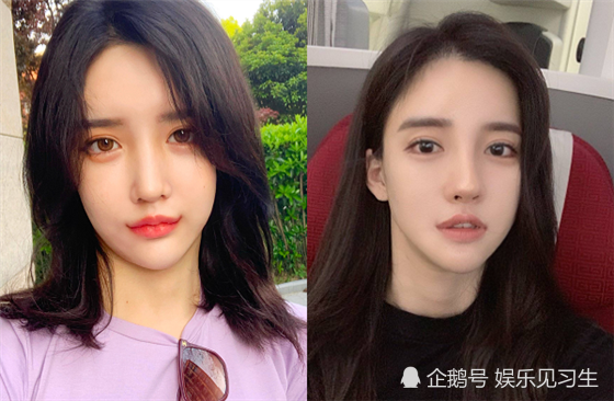 艾比"颜值变迁史":从清纯到网红脸,越来越像潘南奎