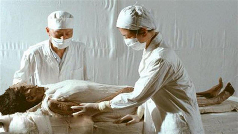 通过手术发现,辛追夫人生前患有多种疾病,包括:冠心病,肺结核,胆结石