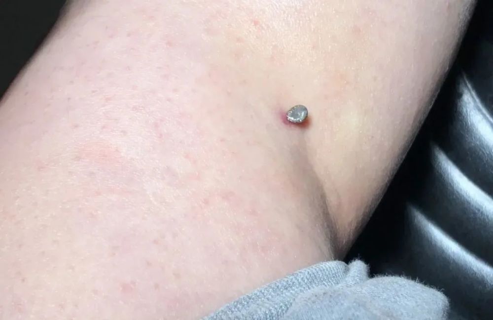 仔细观察发现原来是一只长了8只脚的虫子,头部还钻进了