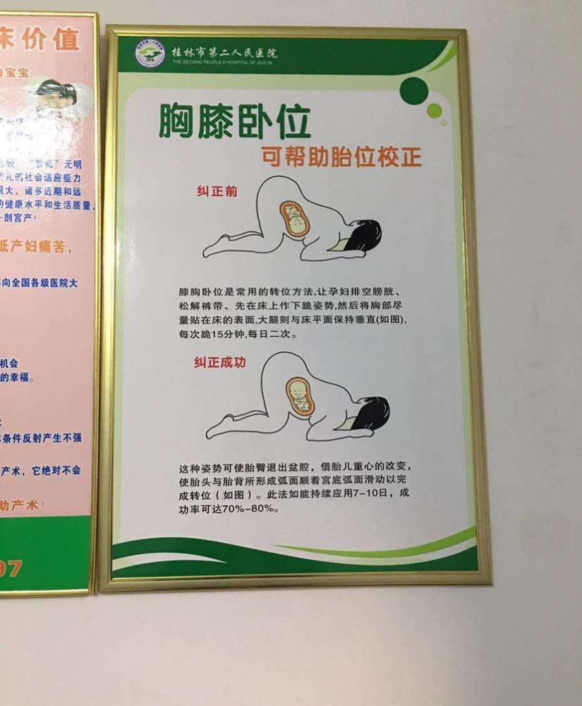 胎位不正在这周之前纠正还可以超过时间再忙活也难转正