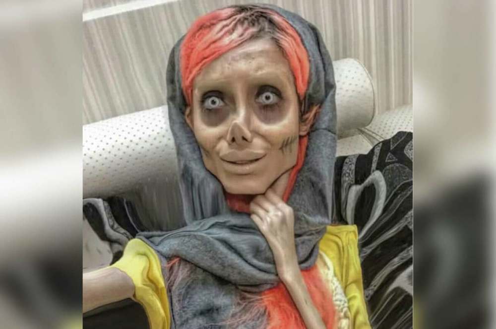 "网红僵尸新娘"出事,确诊感染病毒,正在接受治疗!