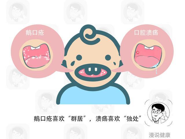 是鹅口疮还是口腔溃疡？宝宝口腔这些“小斑点”，教你6招来辨别_腾讯新闻