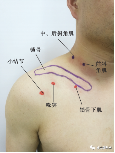 锁骨下肌治疗定点图3.