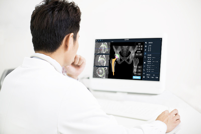 骨科医生的"超级工具","长木谷"获数千万元a轮融资