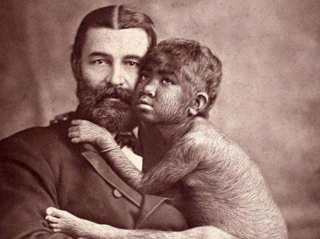 她本是"原始人",却被抓到欧洲沦为赚钱工具,去世遗言让人心痛