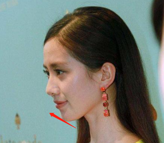 可以说是"侧颜美女"了,不然是后缩下巴或者是漏斗下巴都不会很好看!
