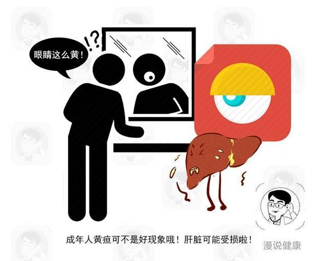 肝硬化|肝硬化一发现就是晚期？身上这4处早就暗示，可惜很多人都忽视