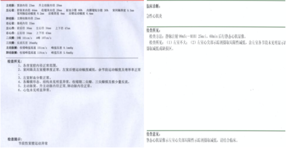 心肌核素检查显示,患者的左室心尖部局限性示踪剂摄取减低,未见明显的