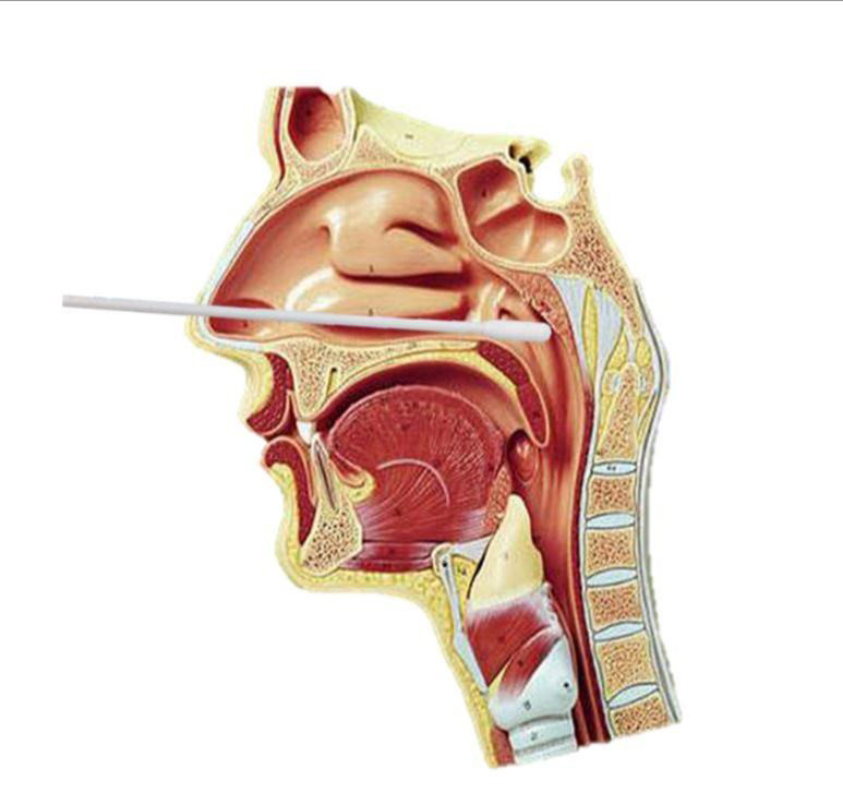 新冠肺炎病毒核酸检测是什么也是抽血检查吗