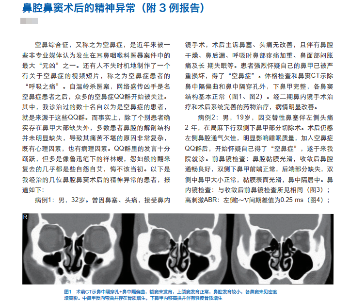 引发数起杀医事件的神秘"空鼻症,是医疗过失还是患者癔病?_腾讯新闻