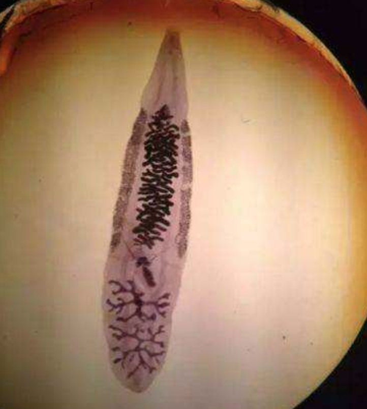 我们常吃的这些食物里,竟有这么多种寄生虫!