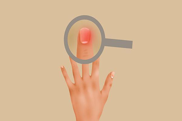 指甲变黑 出现条纹 是怎么回事 暗示身体哪里出问题了 腾讯新闻