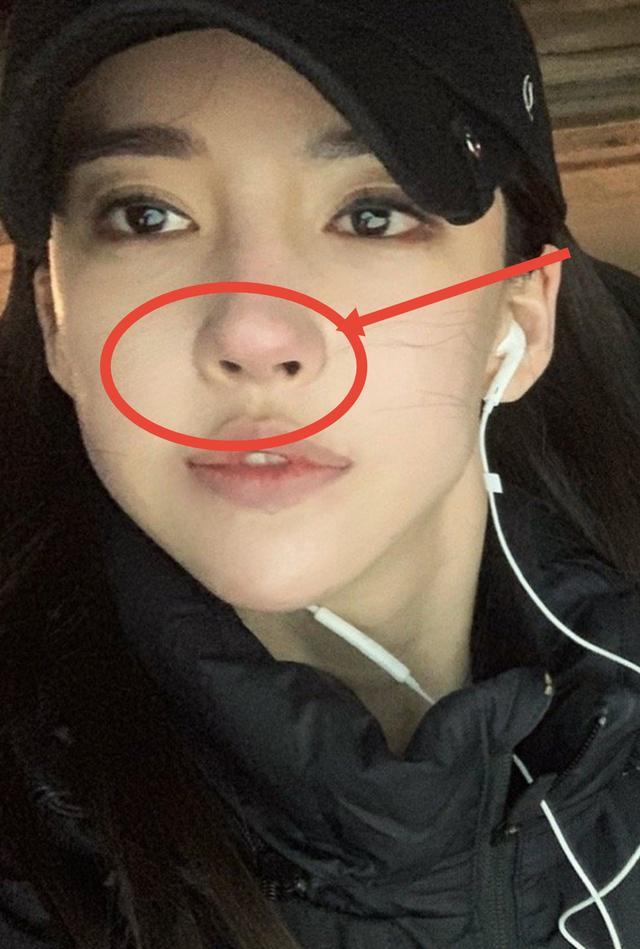 潘南奎整容失败不敢露脸,只敢黑夜晒自拍,却被"朝天鼻"抢镜