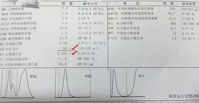 一天伴头晕的病人血常规报告单,血常规报告单呈现典型的失血性贫血,我
