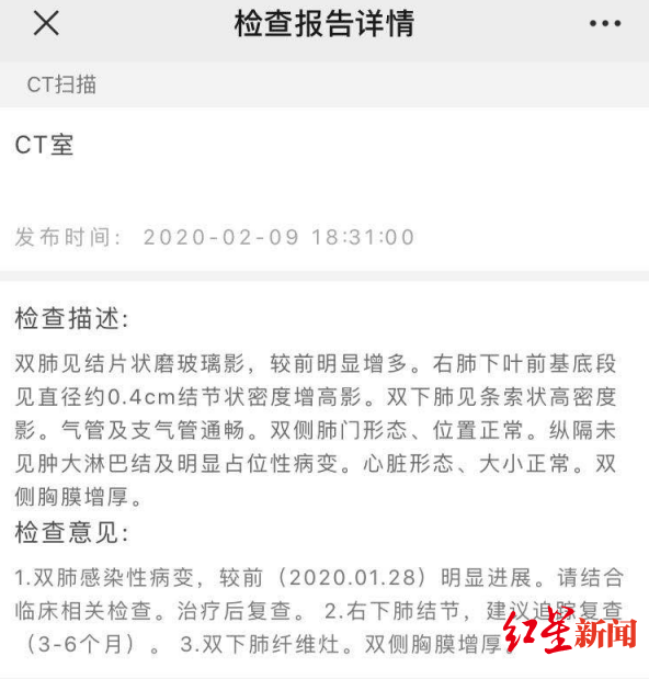 出院的新冠重症病人：66天历经4家医院，可能要“终身吸氧”（组图） - 1
