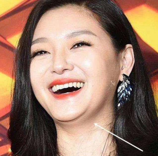 同样胖到现双下巴大美女佟丽娅还是比范冰冰李湘霍思燕大s漂亮