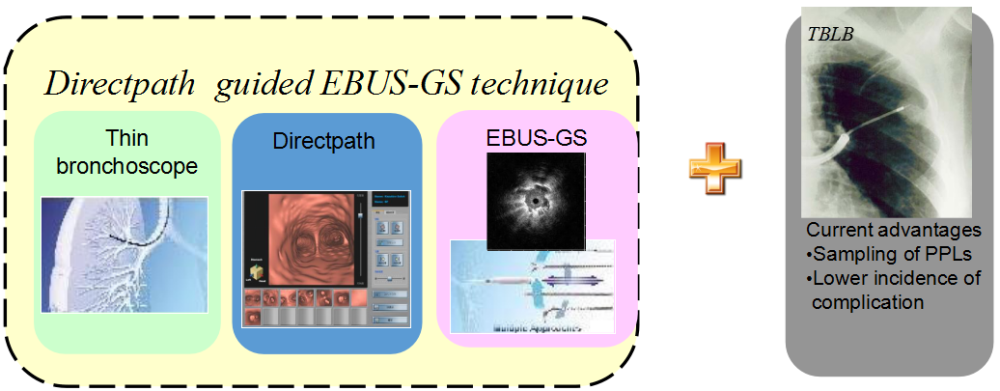 vbn-ebus-gs-tblb技术虚拟导航支气管镜(vbnⅢ型:异质型Ⅲa:点状