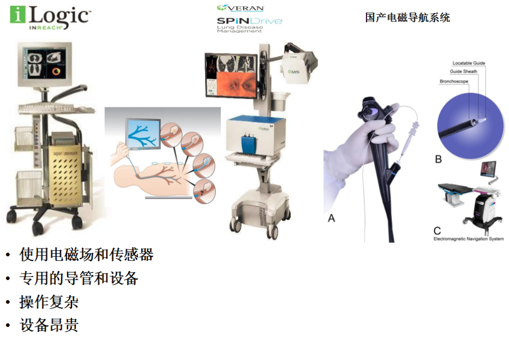 电磁导航支气管镜(enb:气管镜装上gps这是经典的文献,发现ebus-gs