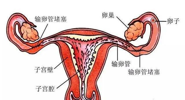 輸卵管結紮術後復通懷孕的成功率大嗎