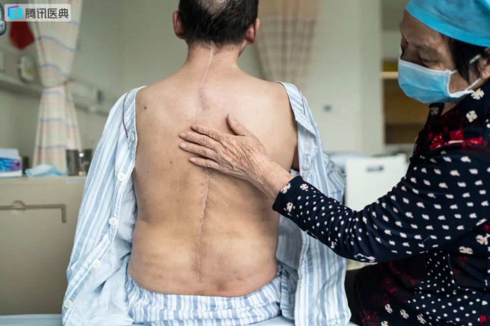 折叠人漫长求医28年!4次手术后终于能看见母亲头顶的白发