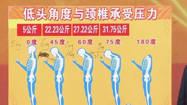 別再做了這些行為習慣傷頸椎損腰椎毀膝蓋