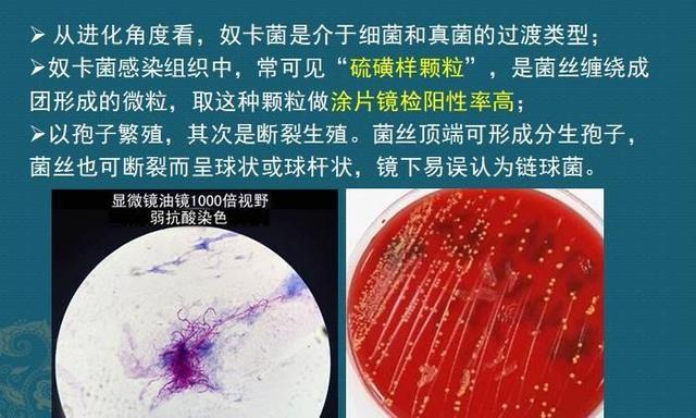 这个细菌提醒你别买病死鱼它是个吃草的细菌后来学会了吃鱼