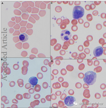 外周血涂片染色图片