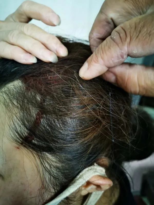 景德镇一小区保洁阿姨被高空抛物砸破头!有种丢咋就没种认?_腾讯新闻