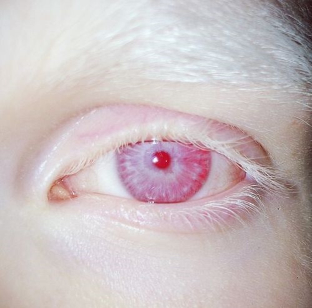 人类最罕见的眼睛颜色是什么眼睛颜色背后的科学