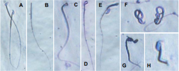 新研究 瑞德西韦小鼠实验中有生殖毒性 严重影响精子质量 腾讯新闻