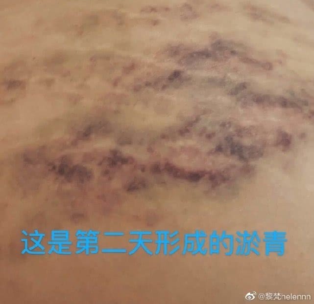 屈楚萧前女友自称“婊子”，恶毒，其心可诛，删博想讨屈楚萧开心