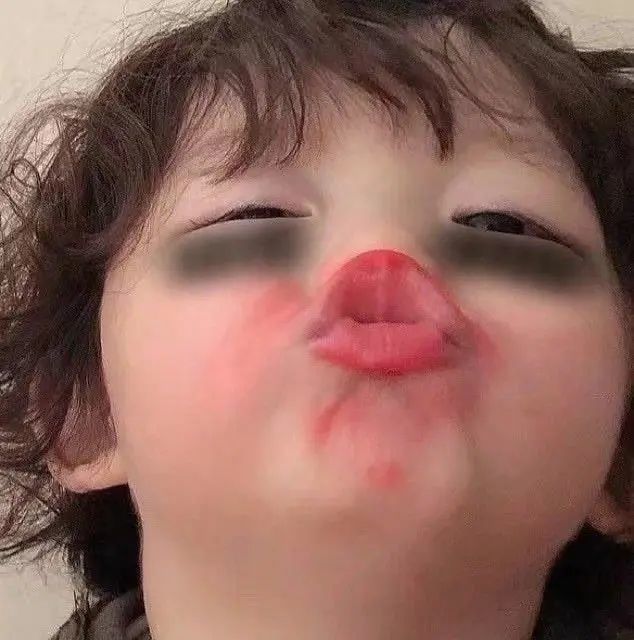 表情包:小女孩黑眼圈表情包_腾讯新闻