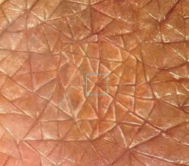 把你的皮肤在显微镜下放大亿万倍后成啥样?网友:这画面有点怪异!