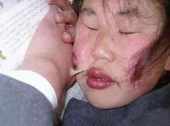 青春期最"糟蹋颜值"的3行为,05后别再盲目跟风,变丑可别哭鼻子