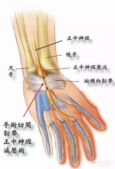 手腕受傷如何練瑜伽?這些技巧和調整方法你要知道!