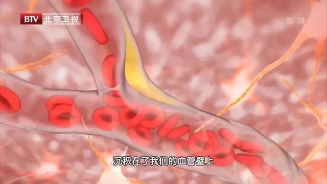 人到中年 血液浓稠 宁可少吃肉也别错过此菜 叶子泡水喝防血栓 腾讯新闻