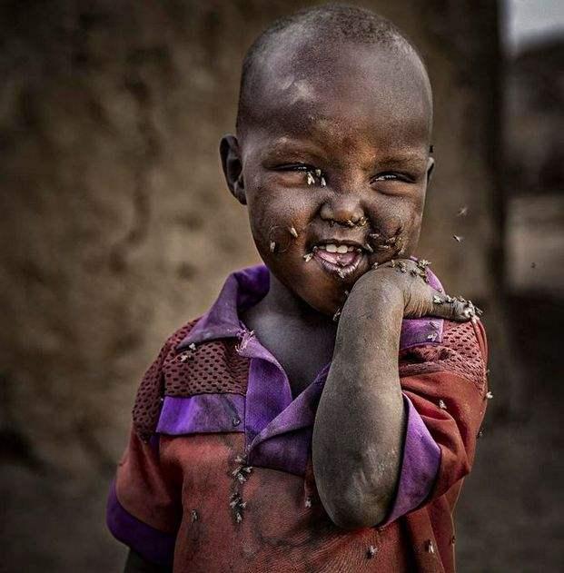 非洲饥饿儿童难民图片