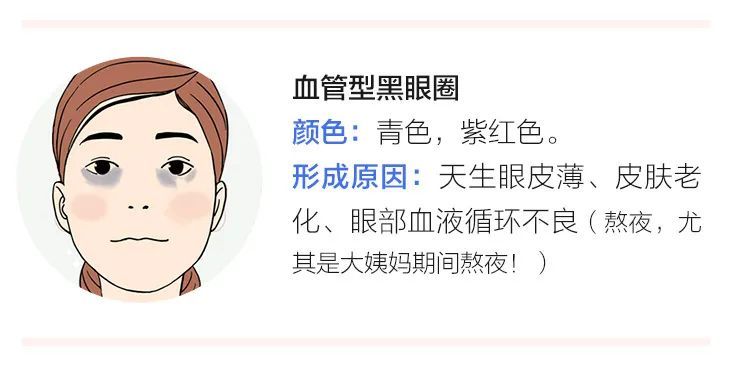 不是所有黑眼圈都是熬夜的 锅 也可能是你老了 腾讯新闻