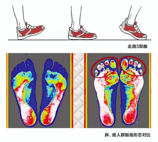 走路姿勢引發腿粗?毀形態還傷關節|肌肉|日本tbs電視臺|腳趾|健身