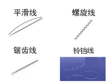 刚做完线雕治疗后,如果做夸张表情会有被拉扯的感觉,这些都是正常现象