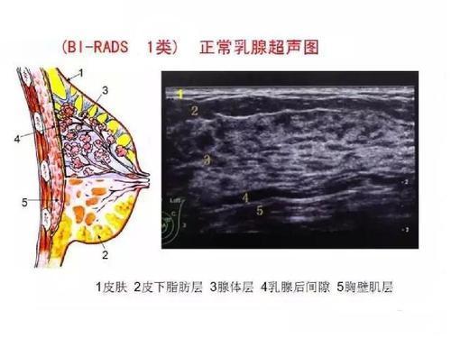 乳腺彩超报告如天书？医生教你解读BI-RADS分类_腾讯新闻